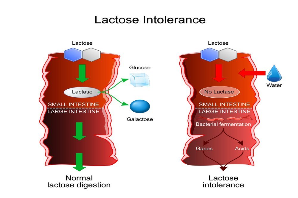 All You Need To Know About Lactose Intolerance