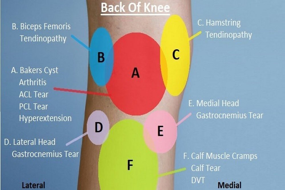 Back Knee Pain Diagnosis Chart