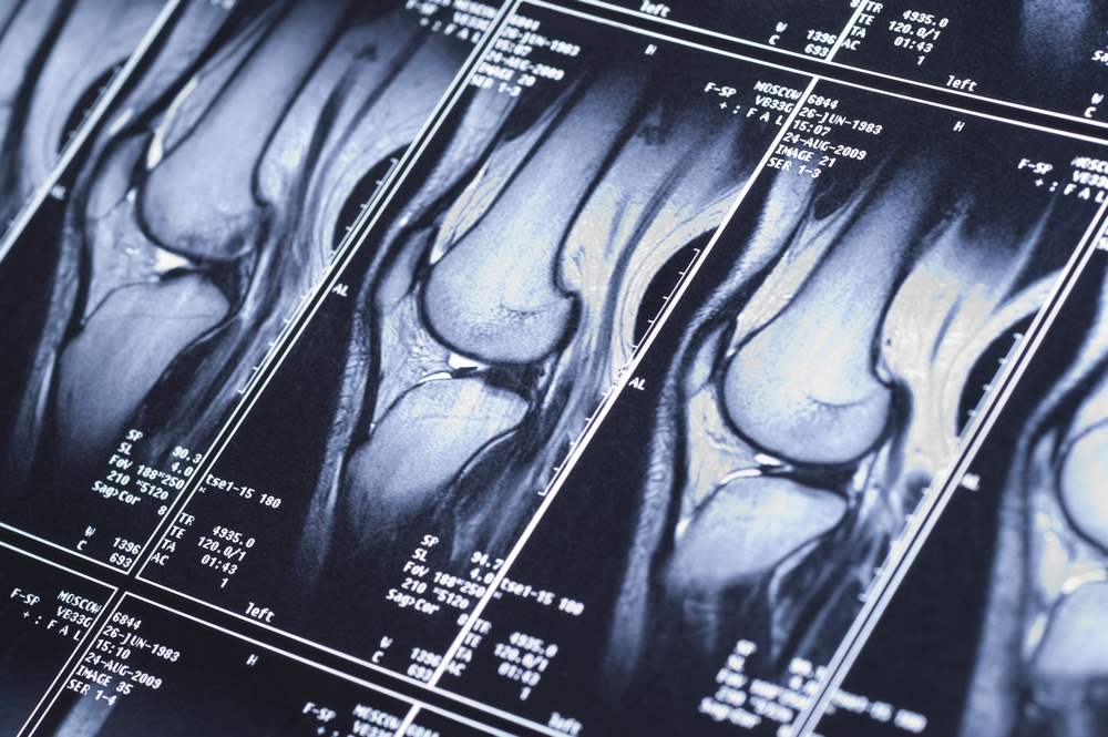 Inner Knee Pain Diagnosis: