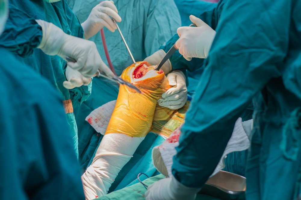 During The Procedure