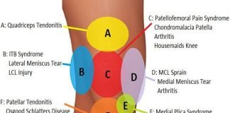 Front Knee Pain Diagnosis Chart