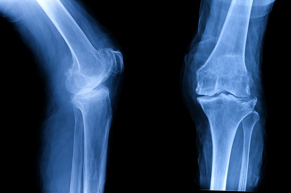 What is the recovery time for inner knee injury?