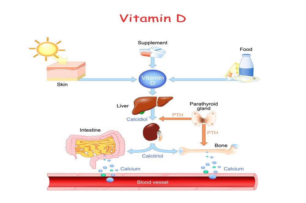 Low vitamin D level