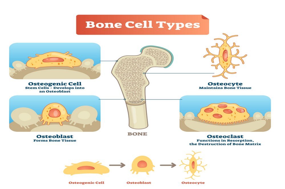Underlying pathology of osteoporosis