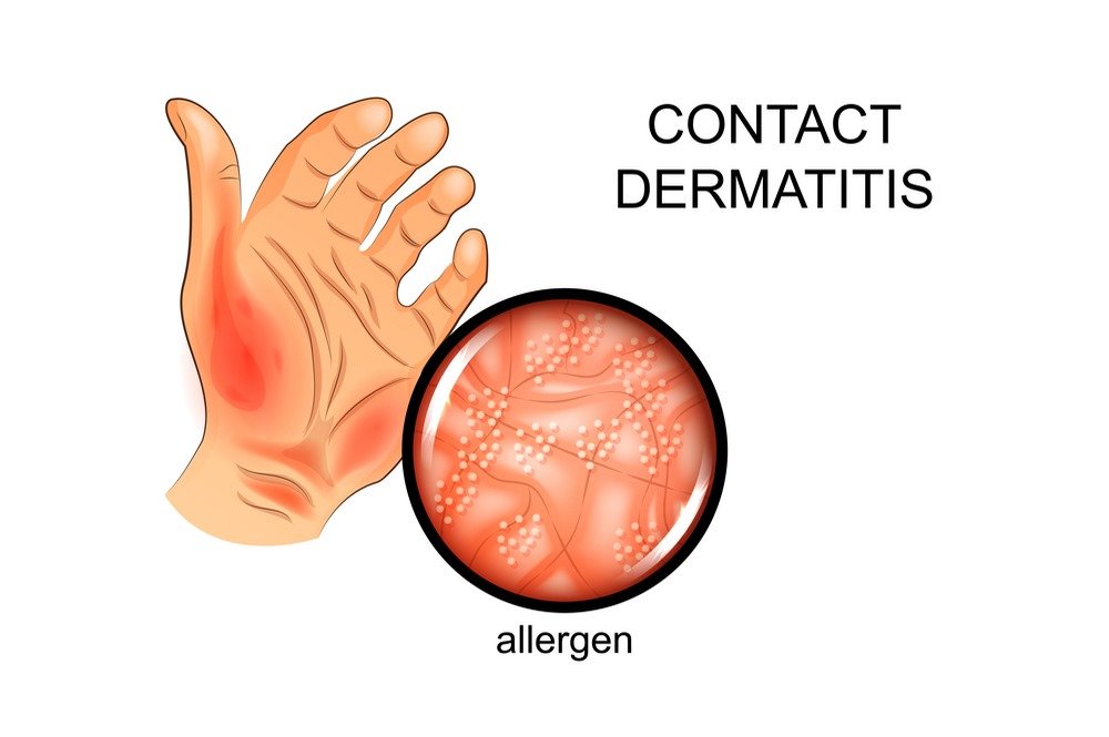 Common Causes Of Skin Rash