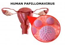 HPV and other common STIs