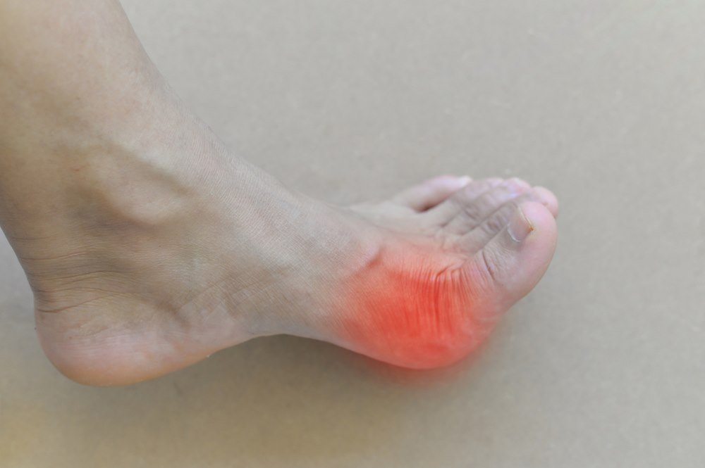 Not To Ignore Symptoms Of Gout