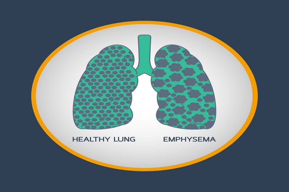 Emphysema Pathophysiology