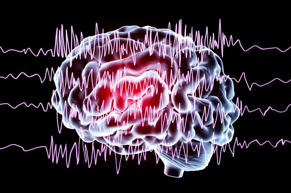 Epilepsy : Definition, Symptoms, Causes, Types, Diagnosis, Medications, Treatment and Management