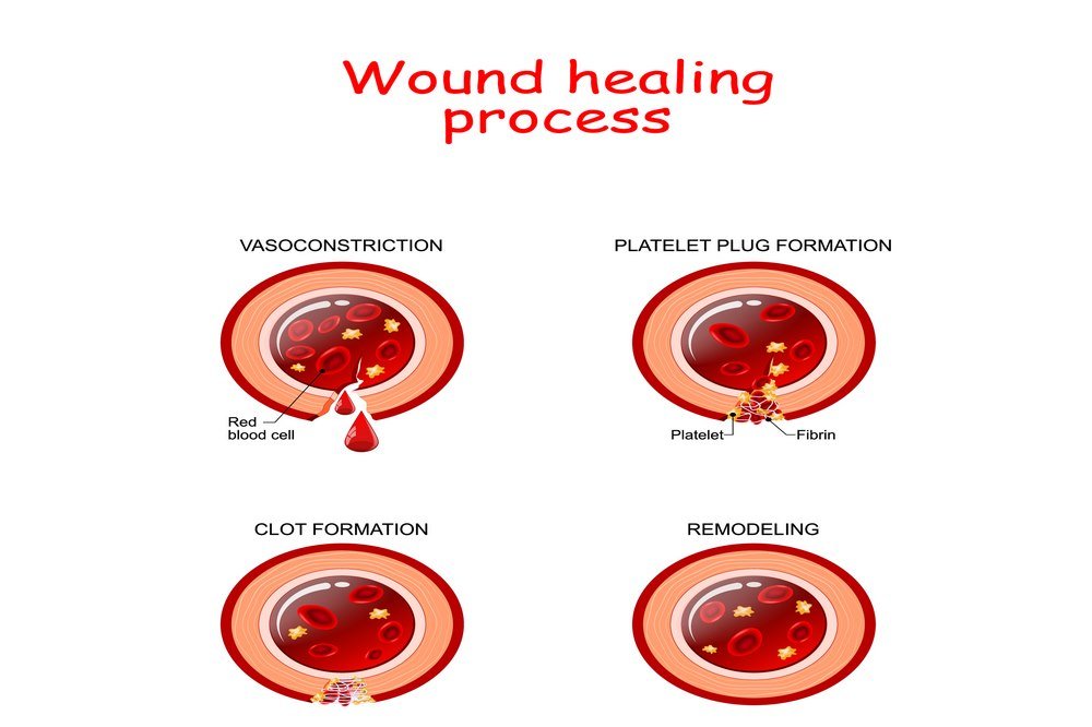 Boost wound healing