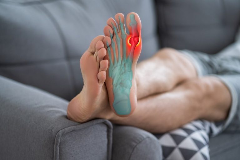 Foot Pain: Causes, Home Remedies, Treatment, and When To Seek Help