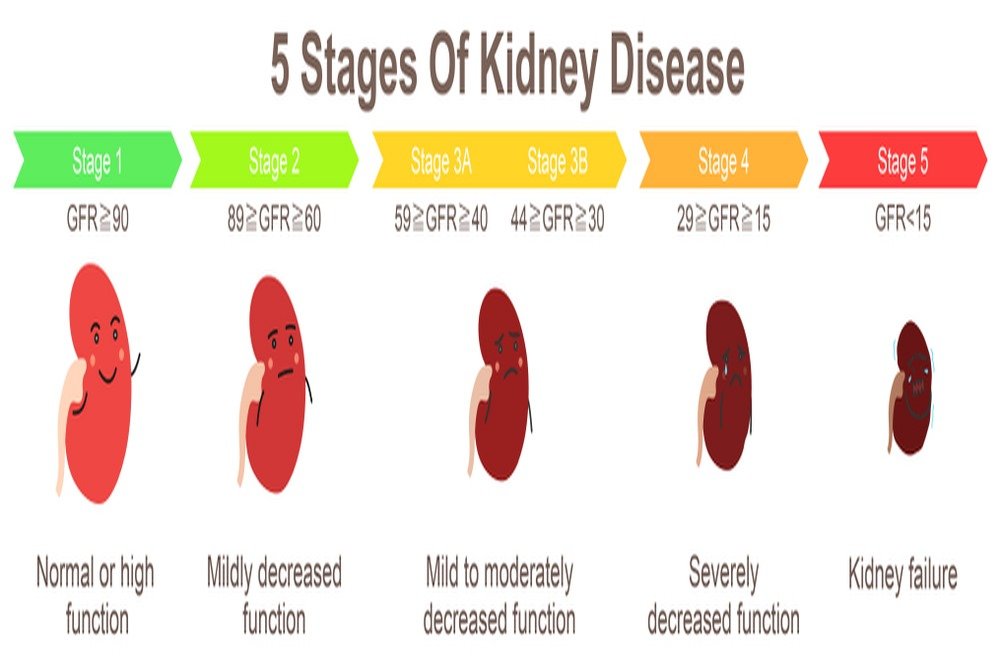  Kidney Disease Stages