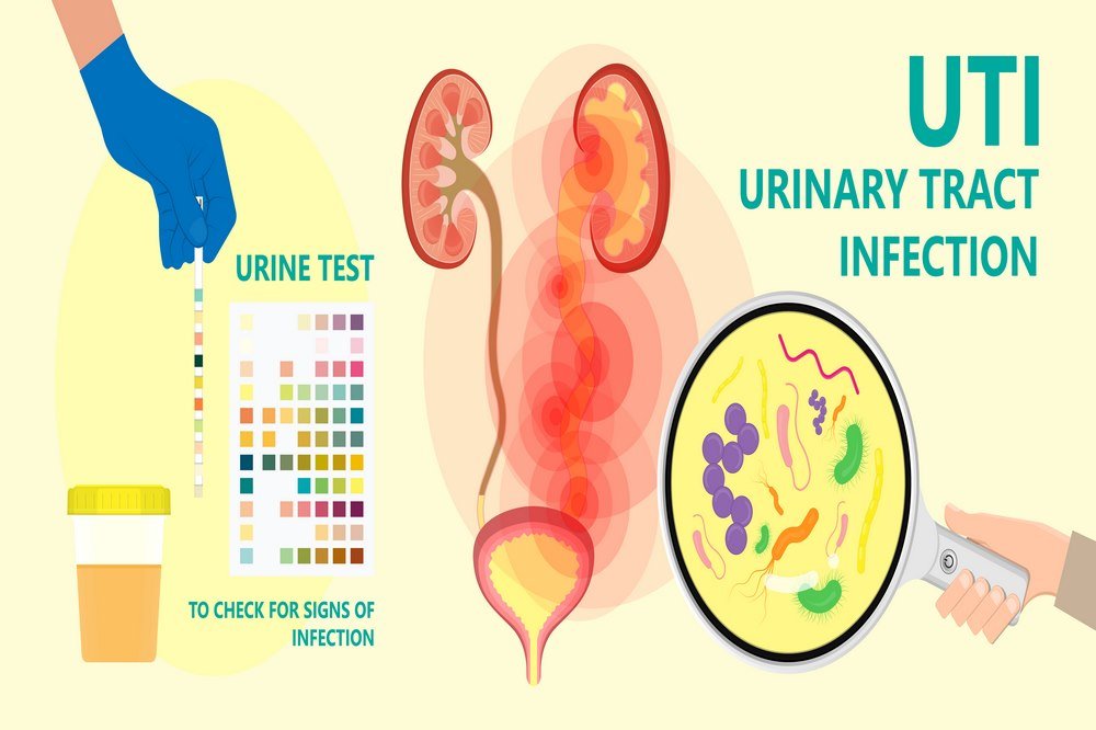Urinary infections repeatedly 
