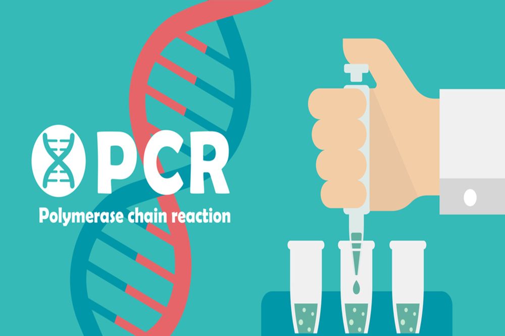 Polymerase chain reaction (PCR) test