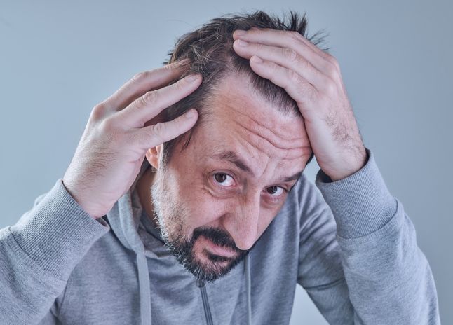 hair loss Symptoms