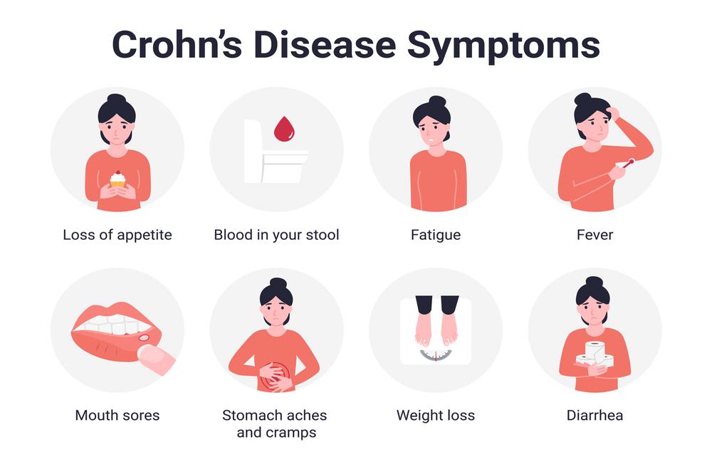 A kind of inflammatory bowel disease known as Crohn’s disease