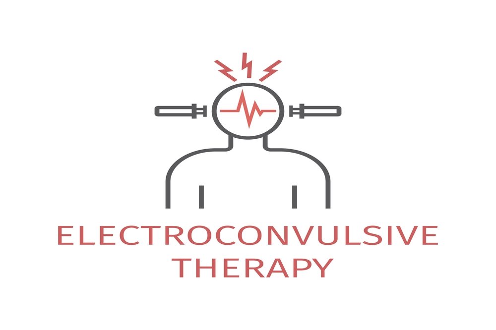 Electroconvulsive therapy (ECT)