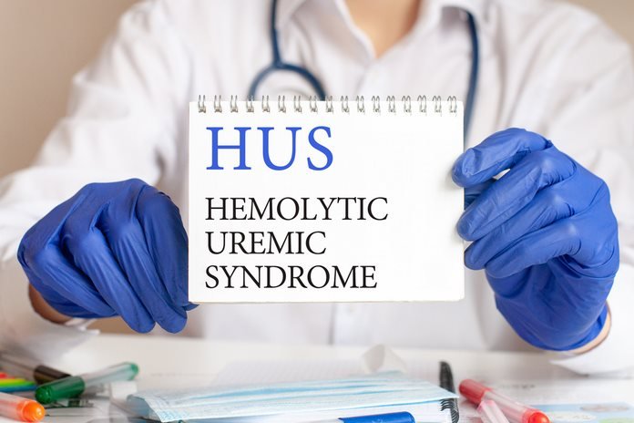 Hemolytic Uremic Syndrome
