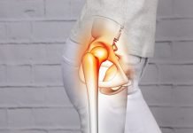 Hip Pain Symptoms, Causes, Treatment, Exercises, Relief & Prevention