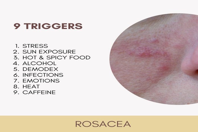 Rosacea Triggers