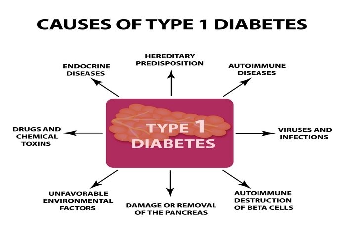 Causes Of Type 1 Diabetes