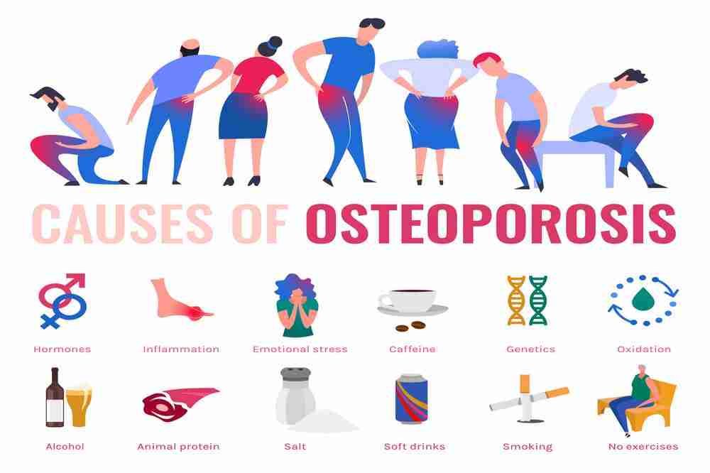 Osteoarthritis Causes and Risk Factors