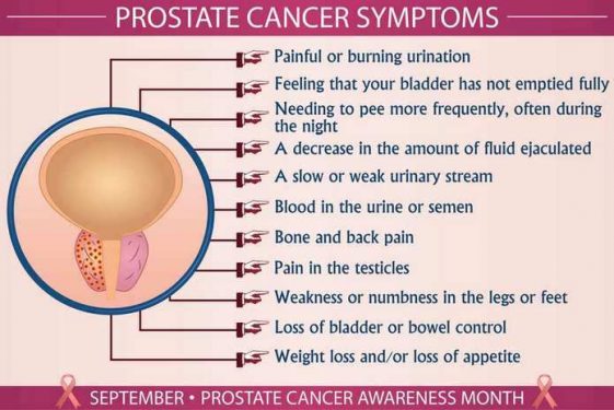 What Is Prostate Cancer Prostate Cancer Guide Page 2 Of 11 Betahealthy 6294