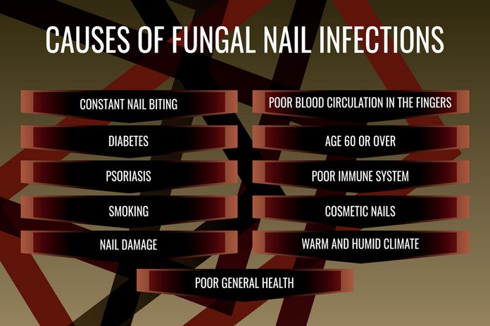 Toenail Fungus Causes