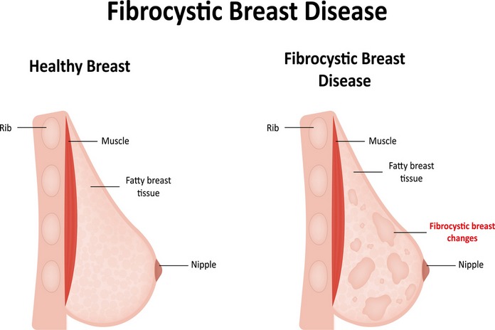 Treats Fibrocystic Disease