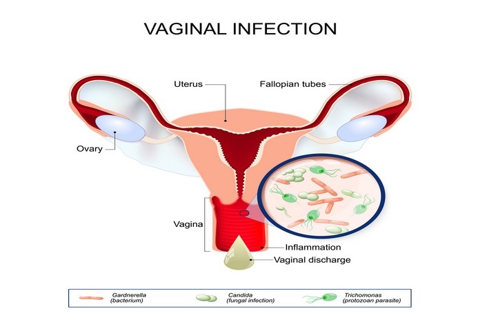 Treats Vaginal Infections