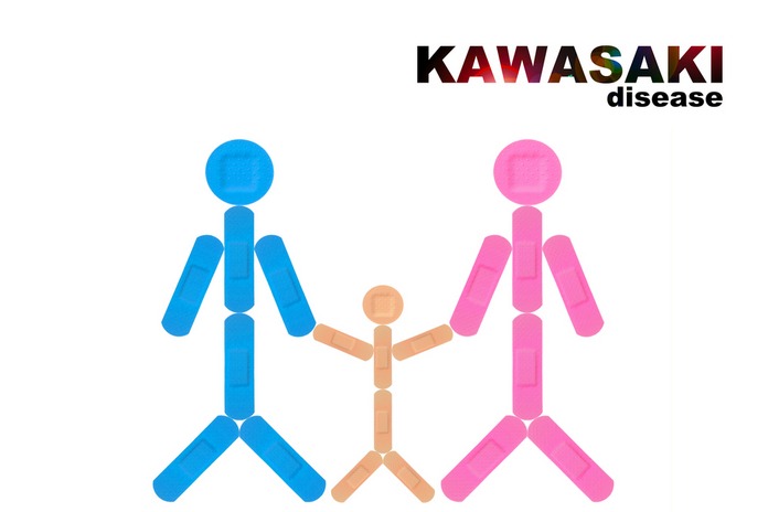 Kawasaki Disease Causes