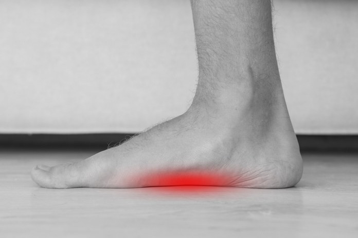Causes of Pain in The Foot Arch