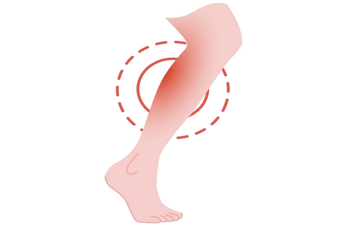 Diagnosis of lower leg pain