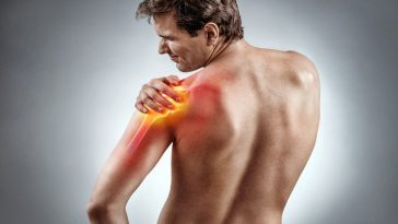How Common Is Shoulder Pain?