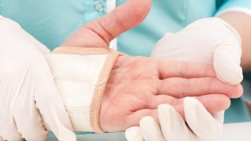 How Is Hand Pain Treated?