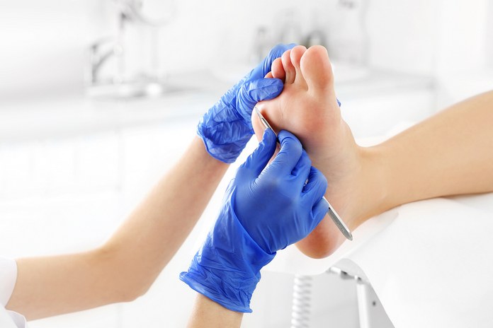 Medical Treatment For Calluses and Skin-Related Foot Pain