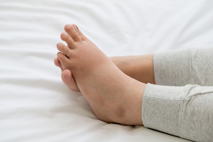 Other Causes of Foot Pain