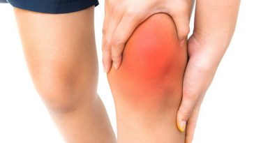 Signs and Symptoms Associated With Knee Pain